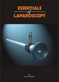 Essential of Laparoscopy
