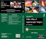 Laparoscopic DVD by Dr R K Mishra