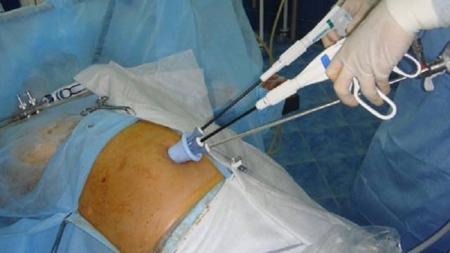 World Laparoscopy Hospital (India - UAE)