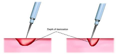 Depth of desiccation is proportional to paddle application time