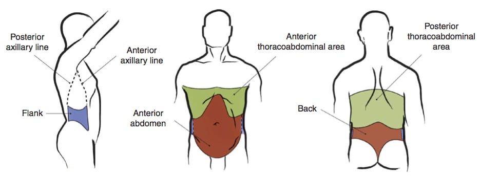 Laparoscopy For Abdominal Trauma Patient