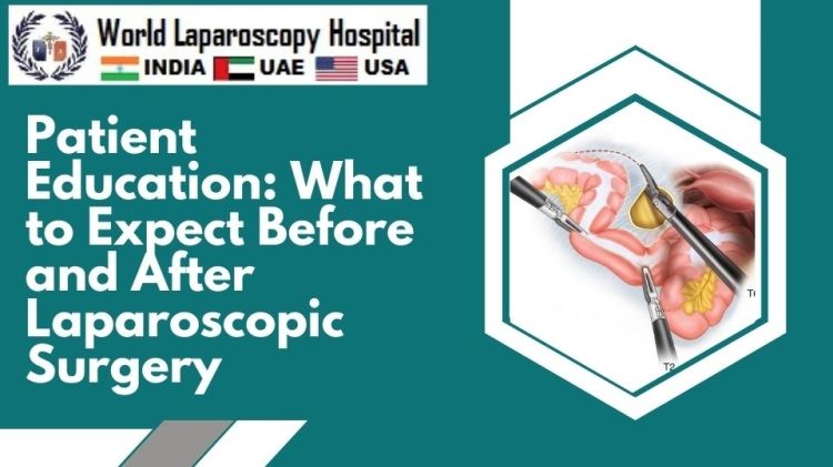 Patient Education What To Expect Before And After Laparoscopic Surgery