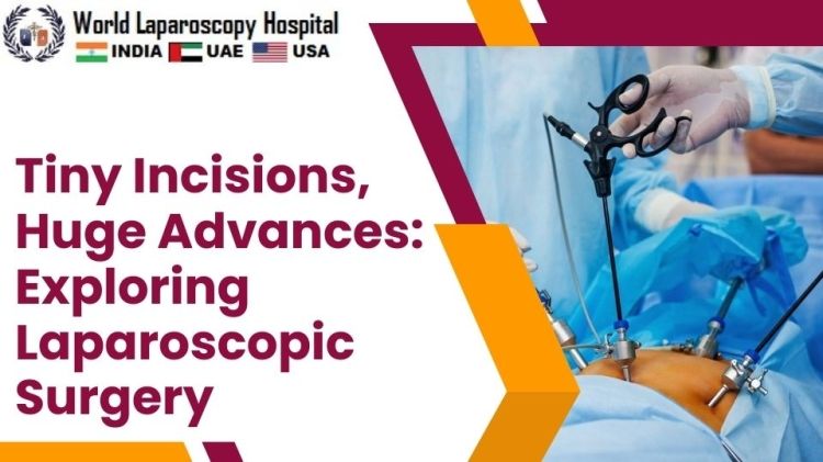 Tiny Incisions, Huge Advances: Exploring Laparoscopic Surgery