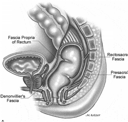 laparoscopic management of undescended testes clip