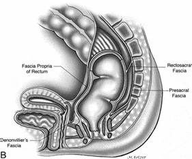 laparoscopic management of undescended testes clip