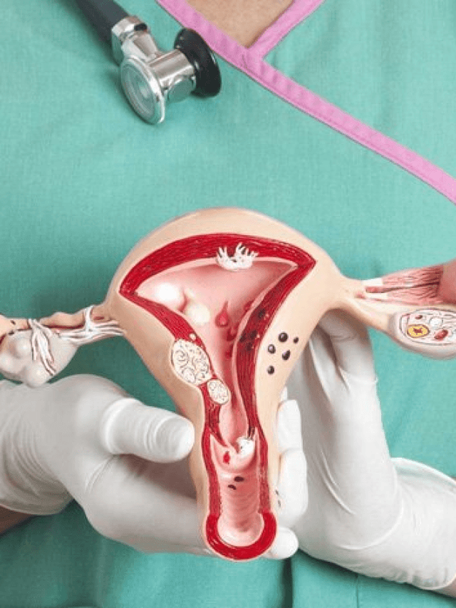 Treatment of Fibroid in Uterus