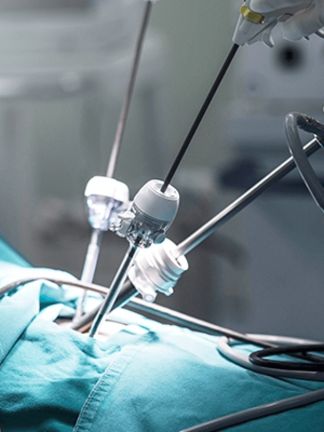 Questions about Laparoscopic Splenectomy