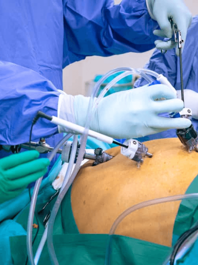 Questions about Laparoscopic Emergencies