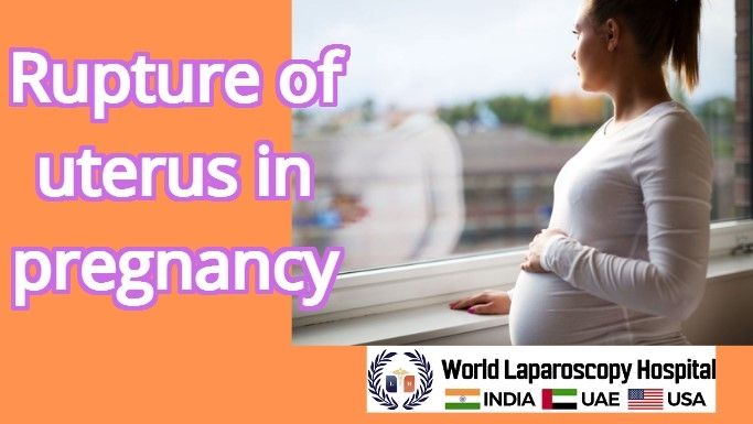 Rupture of uterus in pregnancy