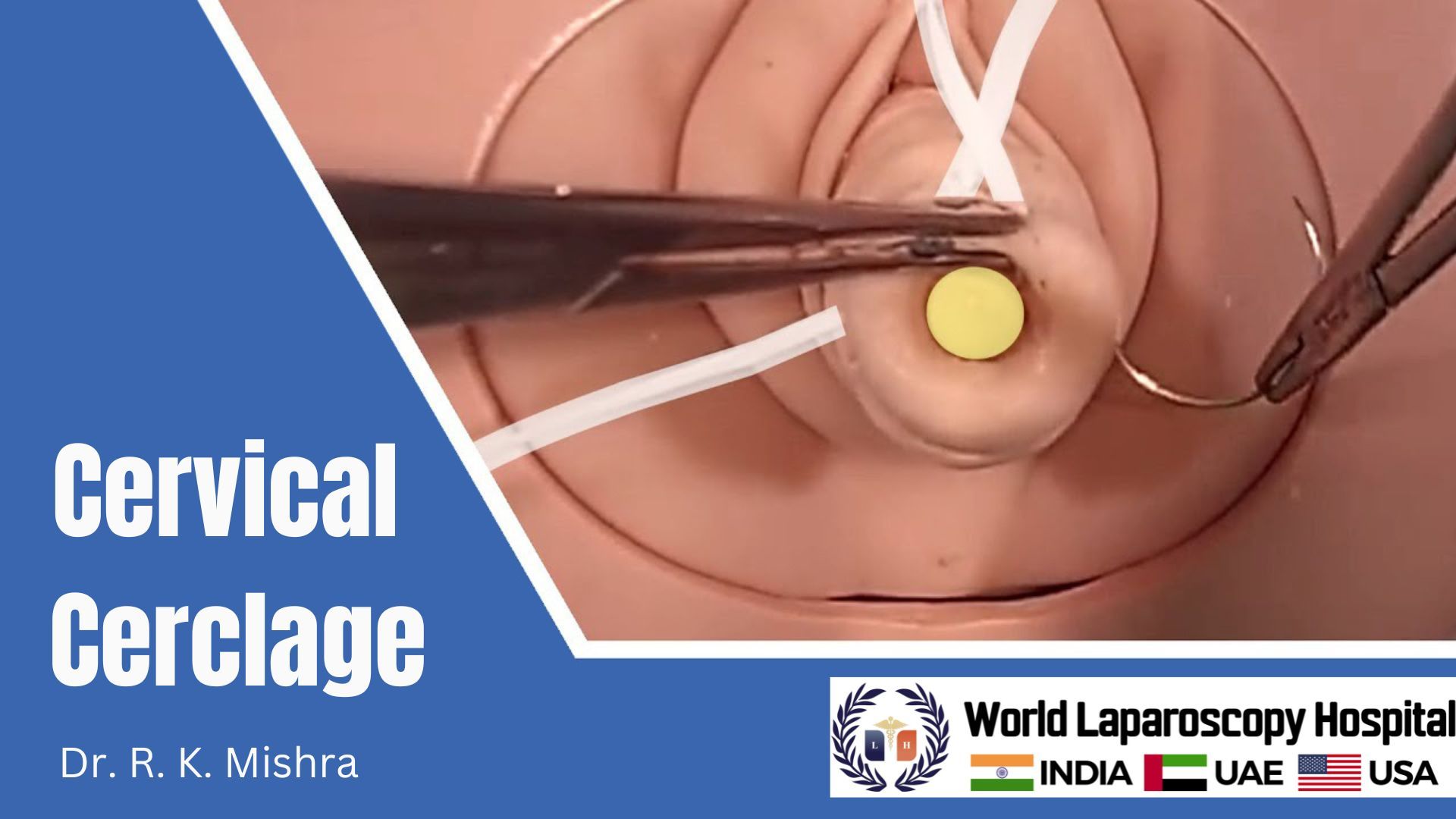 Video lecture on How to Perform Cervical Cerclage