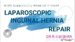 Laparoscopic IPOM Inguinal Hernia Repair - Skin to Skin