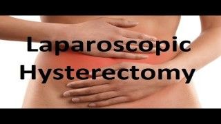 Laparoscopic cervical cerclage