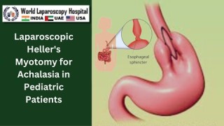 Laparoscopic Heller's Myotomy for Achalasia in Pediatric Patient