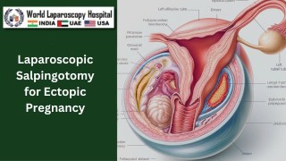 Laparoscopic Management of Ectopic Pregnancy: An Overview