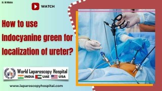 How to use Indocyanine green for localization of ureter?