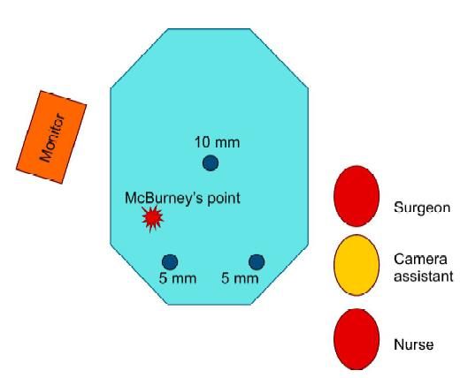 Alternative port position