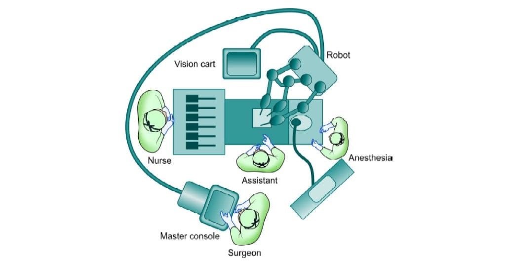 Operating room set-up for cholecystectomy