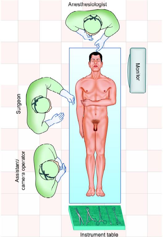 Position of surgical team