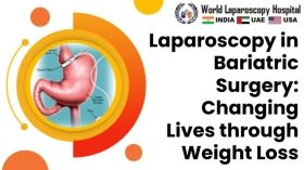 Laparoscopy in Bariatric Surgery: Changing Lives through Weight Loss