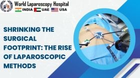 Shrinking the Surgical Footprint: The Rise of Laparoscopic Methods