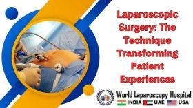 Laparoscopic Surgery: The Technique Transforming Patient Experiences