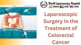 Laparoscopic Surgery in the Treatment of Colorectal Cancer