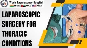 Laparoscopic Surgery for Thoracic Conditions