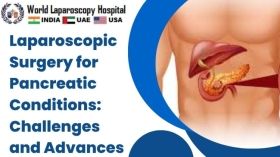 Laparoscopic Surgery for Pancreatic Conditions: Challenges and Advances