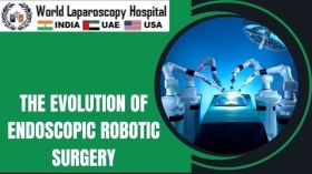 The Evolution of Endoscopic Robotic Surgery