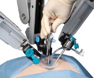 Single Incision Robotic Surgery First Started in Asia at World Laparoscopy Hospital