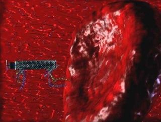 Sensor based Autonomous Medical Nanorobots will be available soon for Minimal Invasive Surgery