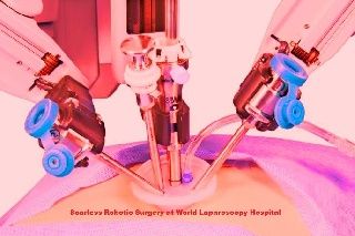 Da Vinci Robotic Scarless Gallbladder Surgery