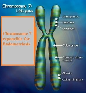 Genetic research gives hope for women with endometriosis