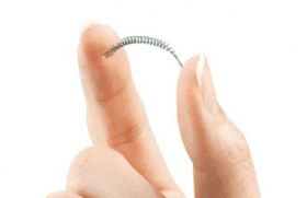 Controversia anticonceptiva de Essure