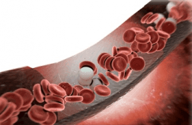 Los efectos inmunológicos de la cirugía: estimular el crecimiento del tumor