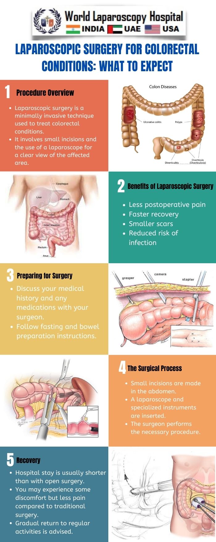 Laparoscopic Surgery for Colorectal Conditions: What to Expect