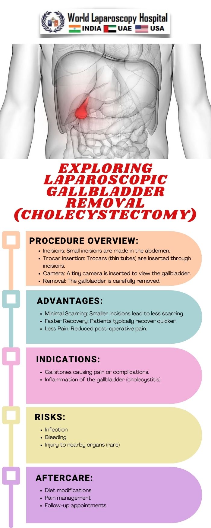 Exploring Laparoscopic Gallbladder Removal (Cholecystectomy)